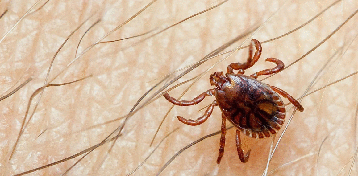 Sindh Confirms First Congo Fever Death of 2025 in Karachi