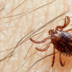 Sindh Confirms First Congo Fever Death of 2025 in Karachi